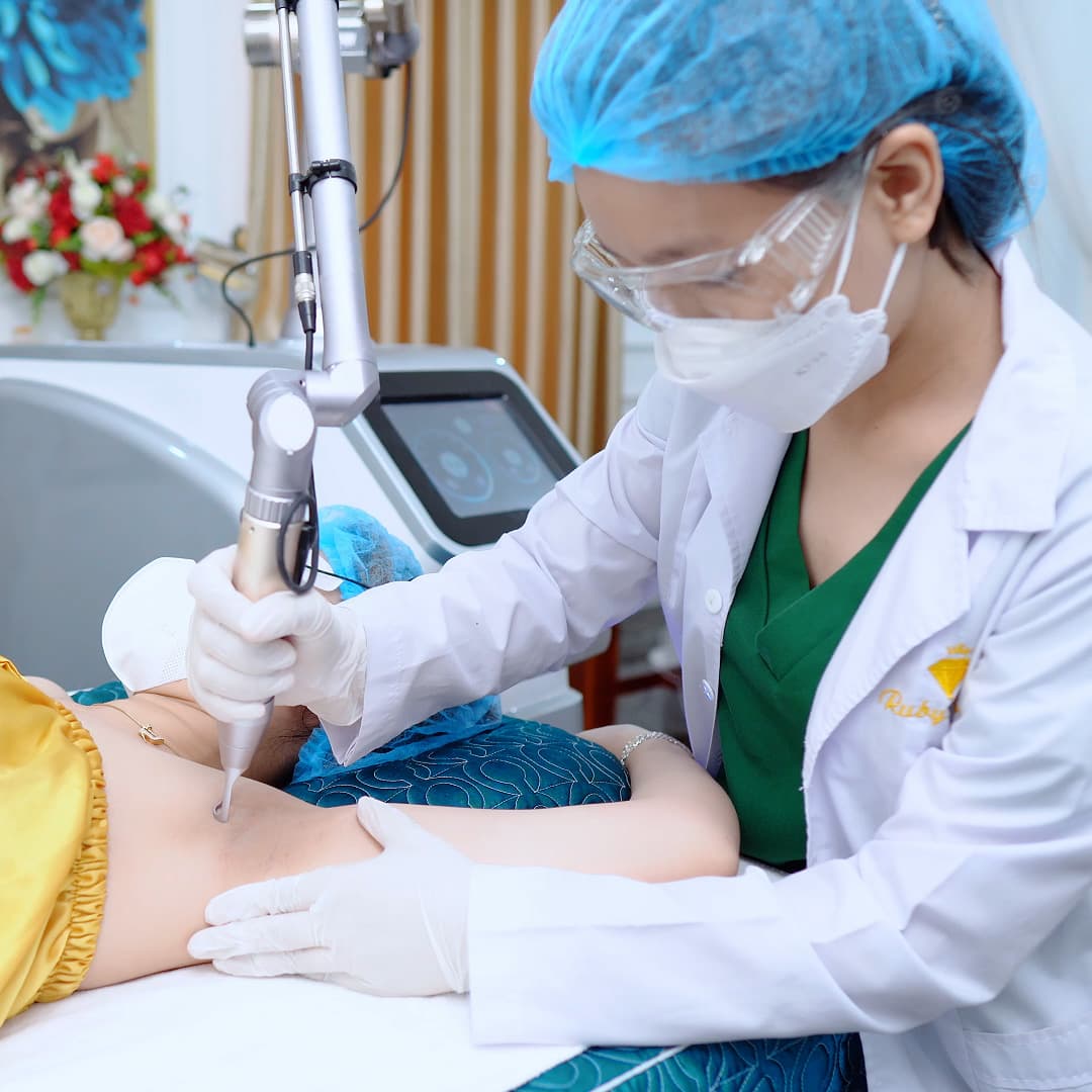 Điều trị thâm Công nghệ Laser Ultra Nano